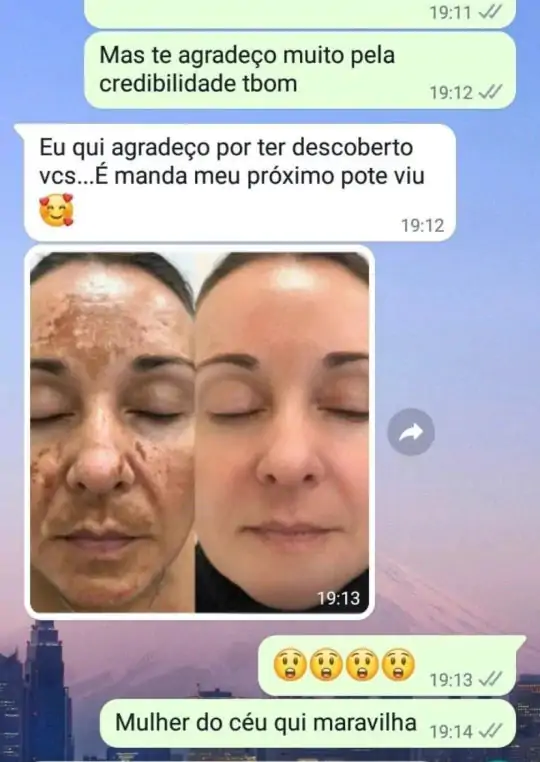 Depoimento cliente Amazolé