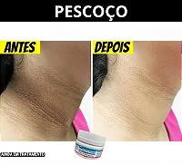 Resultado Amazolé – Antes e Depois