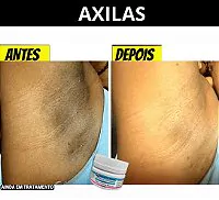 Resultado Amazolé – Antes e Depois